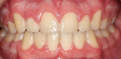 Before & Afters