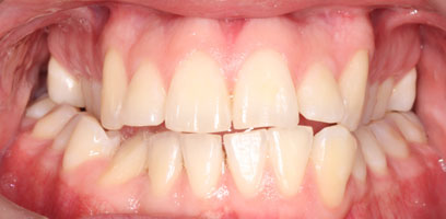 Before & Afters