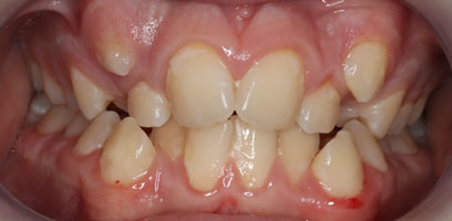 Before & Afters