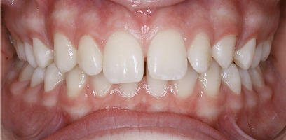 Before & Afters