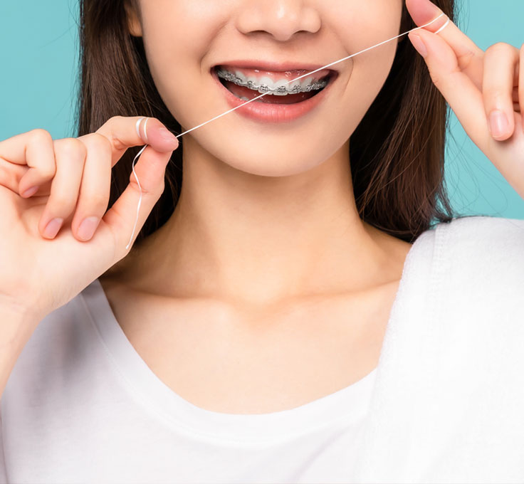 Flossing with braces Flossing with braces